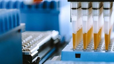 Automation of library preparation