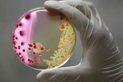 photograph of gloved human hand holding agar plate containing two bacterial cultures
