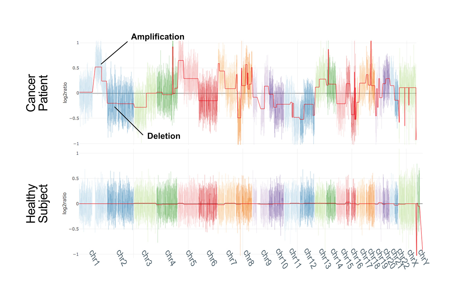 Whole genome CNV profiles of research samples from cancer patients and healthy individuals