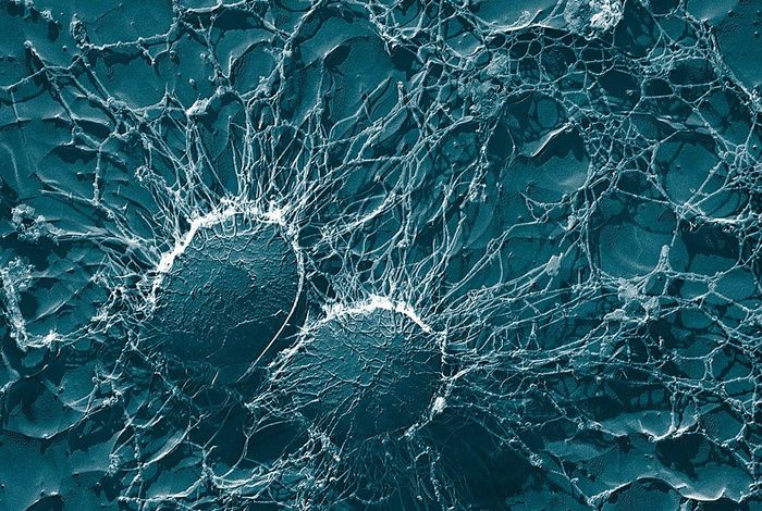Streptomyces spp. From Ethiopia Producing Antimicrobial Compounds: Characterization via Bioassays, Genome Analyses, and Mass Spectrometry