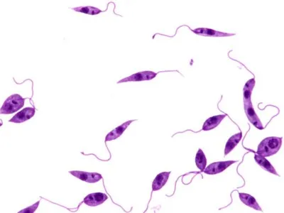 Non-invasive diagnosis of cutaneous leishmaniasis by the direct boil loop-mediated isothermal amplification method and MinION™ nanopore sequencing