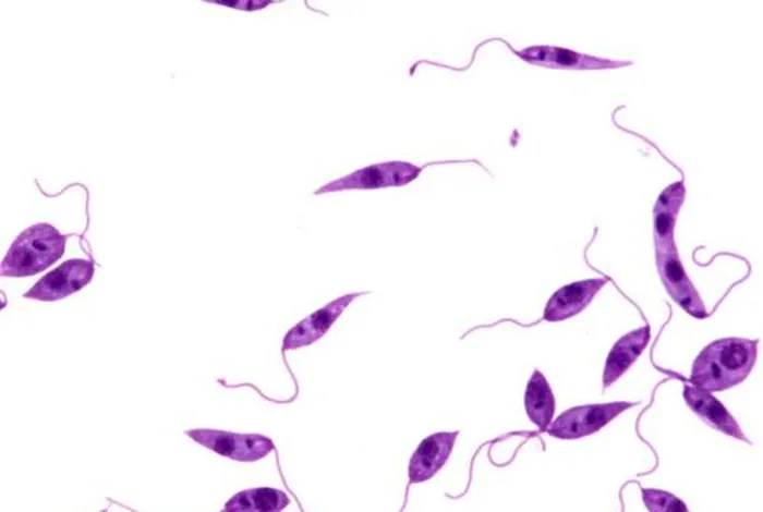 Non-invasive diagnosis of cutaneous leishmaniasis by the direct boil loop-mediated isothermal amplification method and MinION™ nanopore sequencing