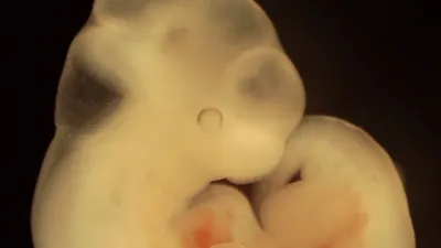 Mouse embryo day 11 on black background