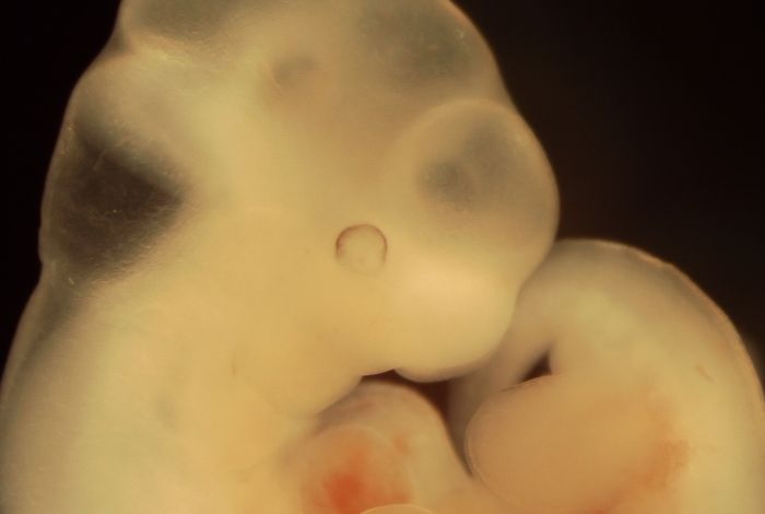 Using long-read sequencing to detect imprinted DNA methylation