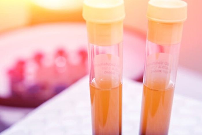 Advancing long-read de novo genome assembly methods in clinical research