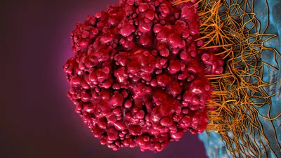 Long-read sequencing of diagnosis and post-therapy medulloblastoma reveals complex rearrangement patterns and epigenetic signatures