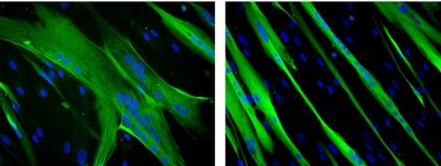 false colour green filaments on black background