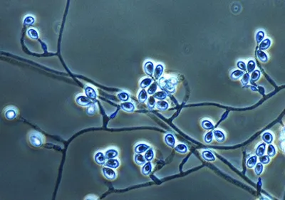 First Draft Genome Sequence of the Pathogenic Fungus Lomentospora prolificans (formerly Scedosporium prolificans)
