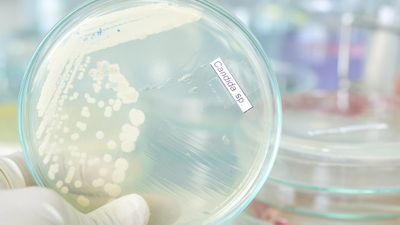De novo whole-genome assembly of a wild type yeast isolate using nanopore sequencing 
