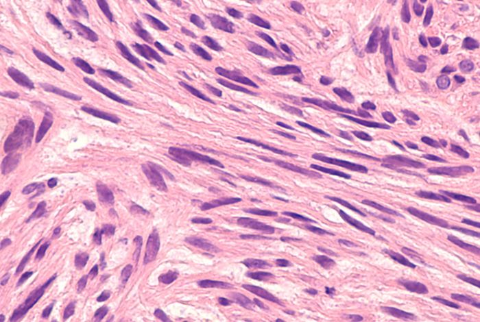Nanopore sequencing reveals full-length Tropomyosin 1 isoforms and their regulation by RNA binding proteins during rat heart development