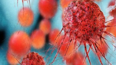 cancer cells