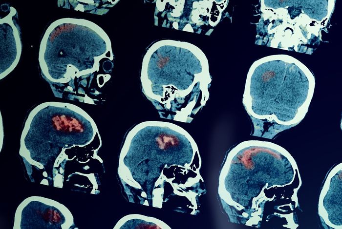 NCM 2021: Real-time cancer classification with nanopore sequencing