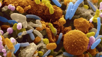 Microbial community - metagenomics