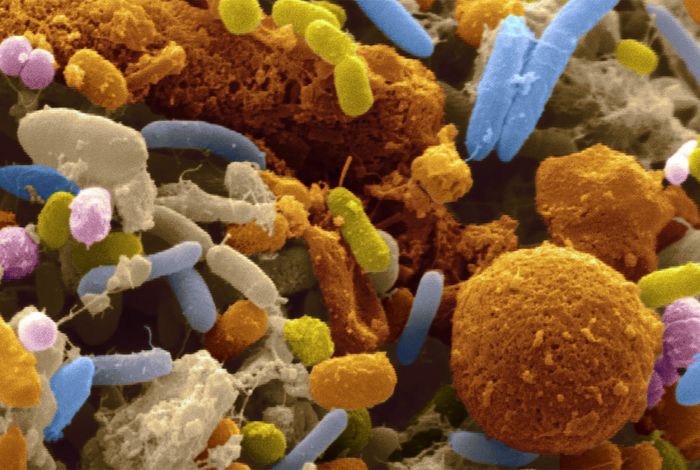 A portable system for rapid bacterial composition analysis using a nanopore-based sequencer and laptop computer