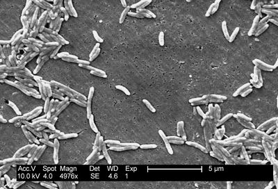 Campylobacter fetus meningitis confirmed by a 16S rRNA gene analysis using the MinION nanopore sequencer, South Korea, 2016