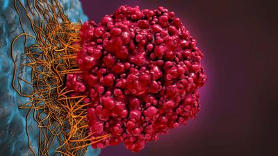 Rapid brain tumour classification from sparse epigenomic data