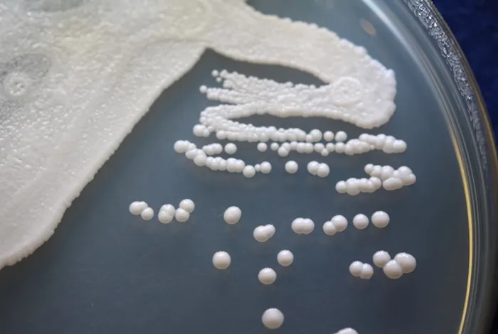 Rapid genome sequencing for outbreak analysis of the emerging human fungal pathogen Candida auris