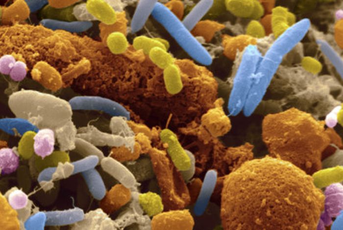 Profiling bacterial communities by MinION sequencing of ribosomal operons