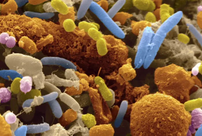 Profiling bacterial communities by MinION sequencing of ribosomal operons