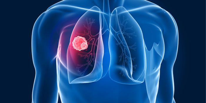 NCM 2021: Phasing analysis of lung cancer genomes using PromethION R10.4