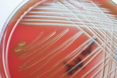 Evaluating the diagnostic utility of 16S ONT sequencing in patients with central nervous system infections and its usefulness in antimicrobial stewardship