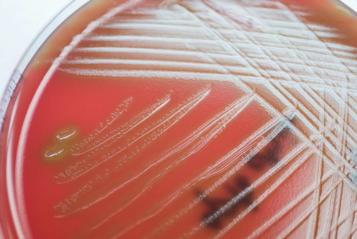 Evaluating the diagnostic utility of 16S ONT sequencing in patients with central nervous system infections and its usefulness in antimicrobial