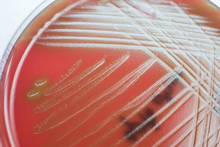Evaluating the diagnostic utility of 16S ONT sequencing in patients with central nervous system infections and its usefulness in antimicrobial