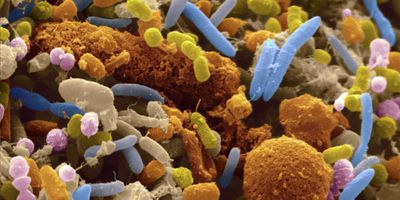 Swine influenza-modified pulmonary microbiota