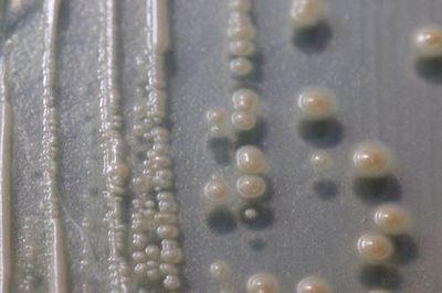 Close up of yeast colonies on agar in petri dish