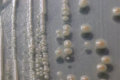 Close up of yeast colonies on agar in petri dish