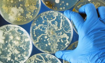 Bacteria growing in a petri dish