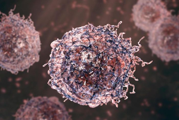 Diagnosing intravascular B-cell lymphoma using nanopore sequencing of cell-free DNA from cerebrospinal fluid