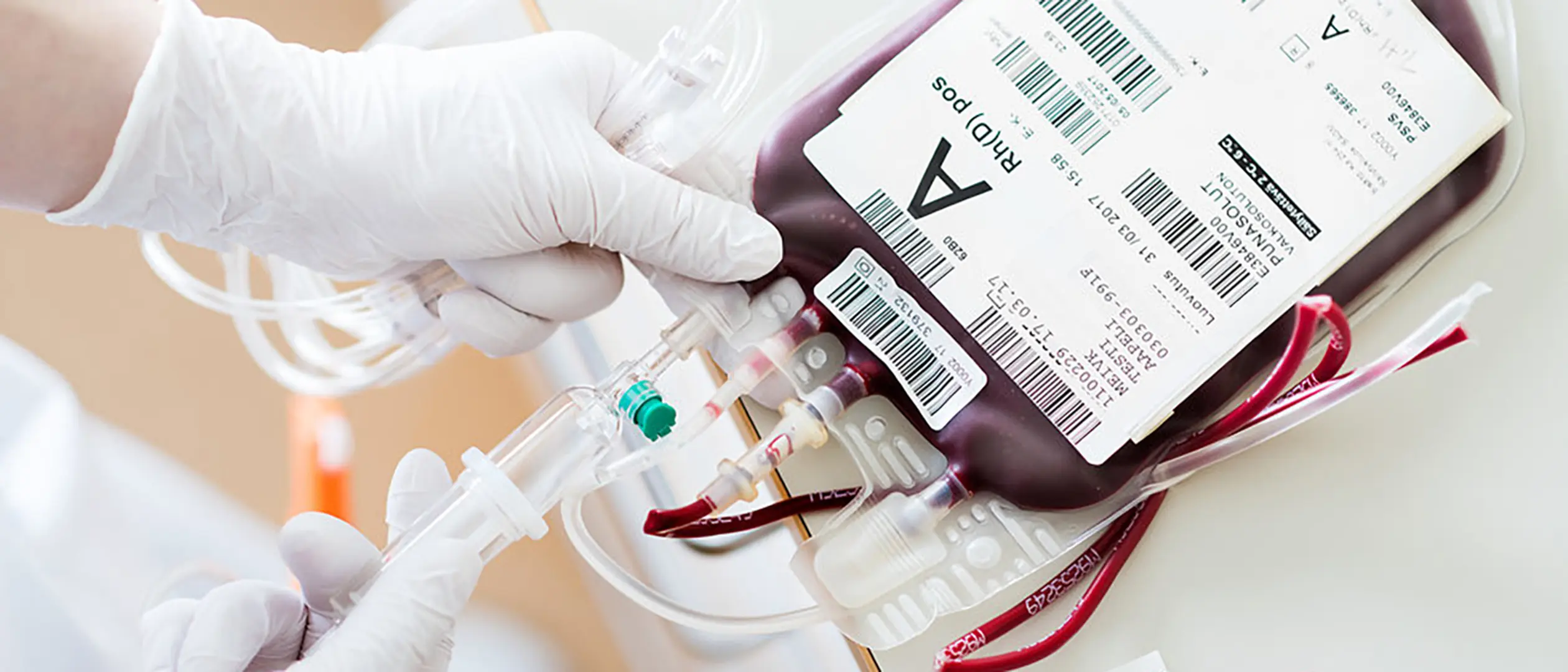 Vårdväskans Backspegel: Blodgivningens historia – från dödliga experiment till livräddande rutin