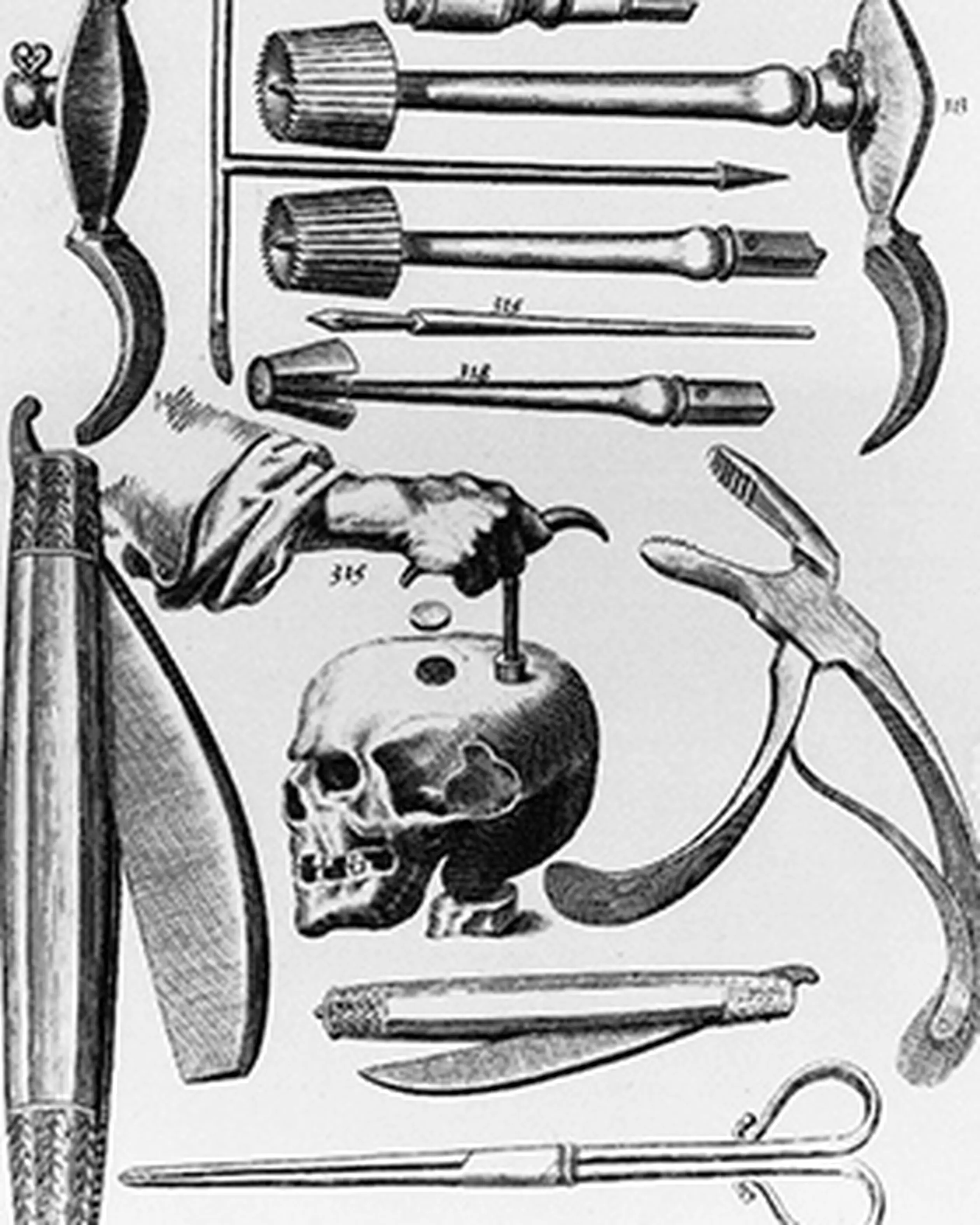 Vårdväskans Backspegel: Historiens märkligaste behandlingsmetoder
