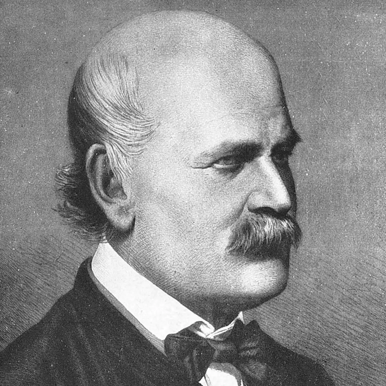 Vårdväskans Backspegel: Hygienens genombrott i vården – från klorkalk till handsprit