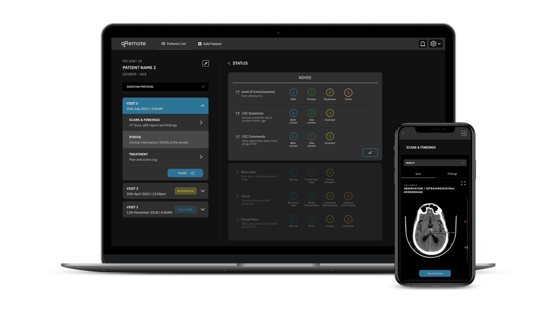 Qure.ai raises US$40 million to sell chest X-ray AI beyond India