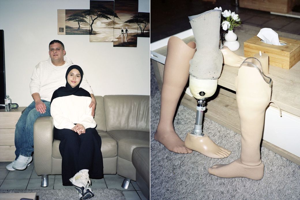 twee afbeeldingen naast elkaar met Ahed Bseiso en haar oom die in een zetel zitten, en een foto van drie protheses die Ahed gebruikt