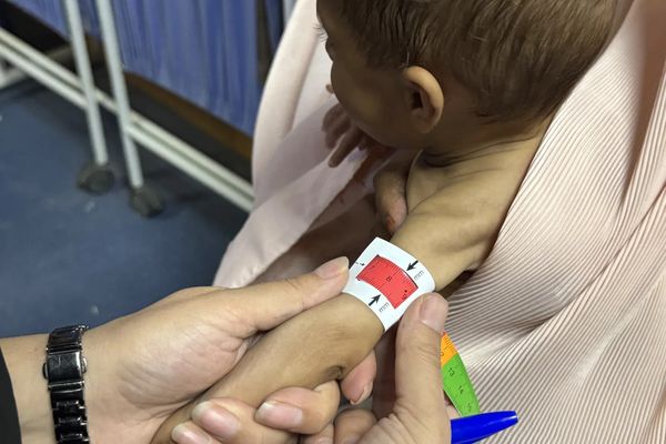 MSF Afghanistan