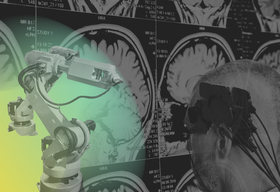 What it takes to build frontier technology in healthcare