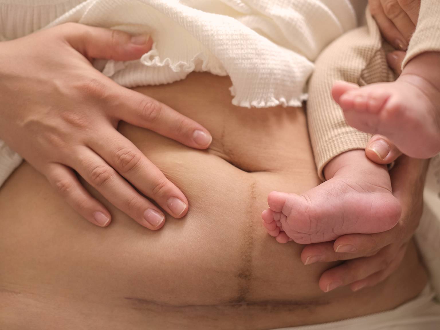 Der Bauch einer Frau nach der Geburt mit einer Linea nigra, die sanft von ihrer Hand berührt wird, während sie die Füße eines Babys hält.