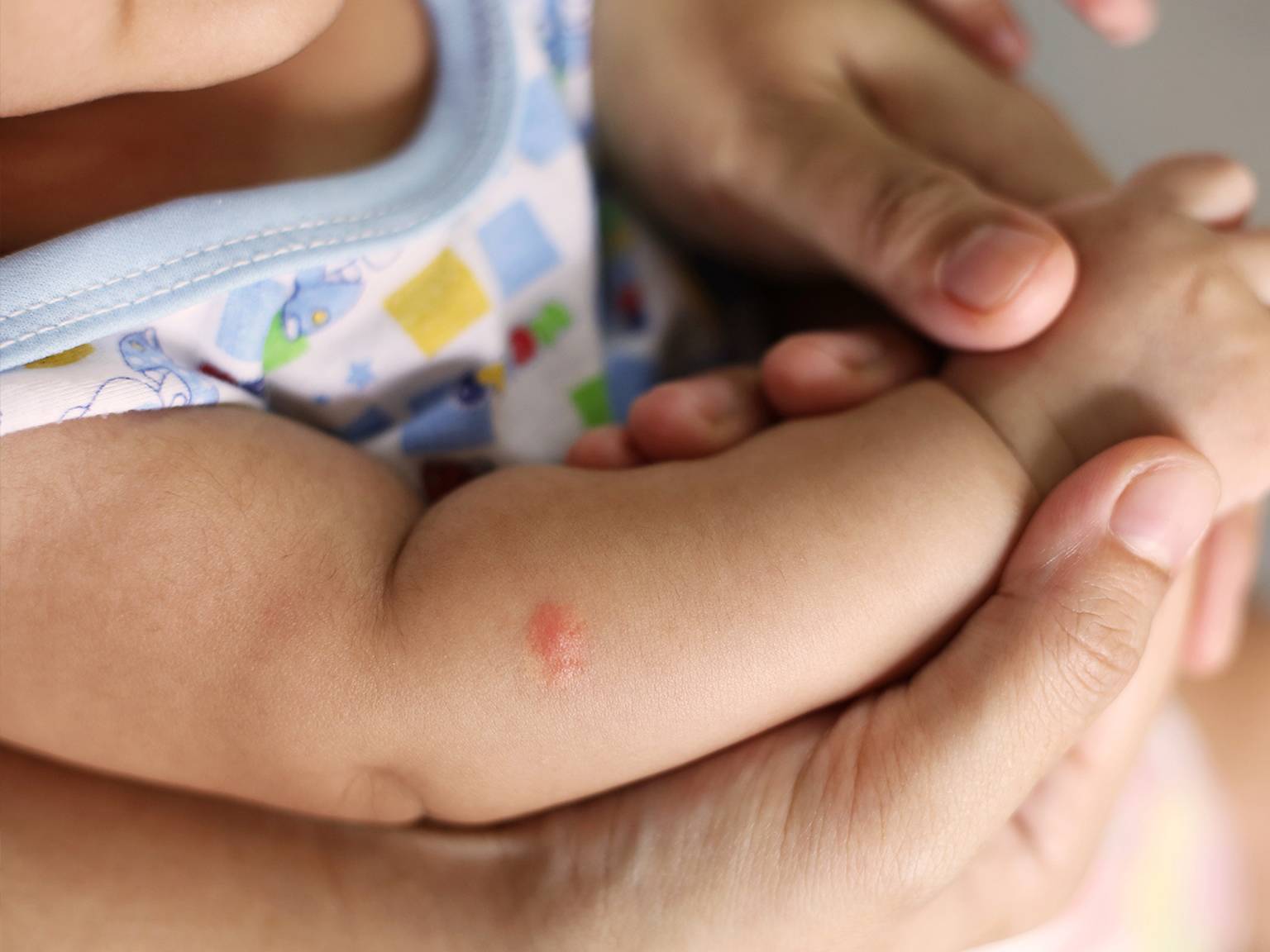 Nahaufnahme des Arms eines Babys mit einem kleinen roten Stich, der sanft von den Händen eines Erwachsenen gehalten wird. Das Baby trägt ein gemustertes ärmelloses Hemd.