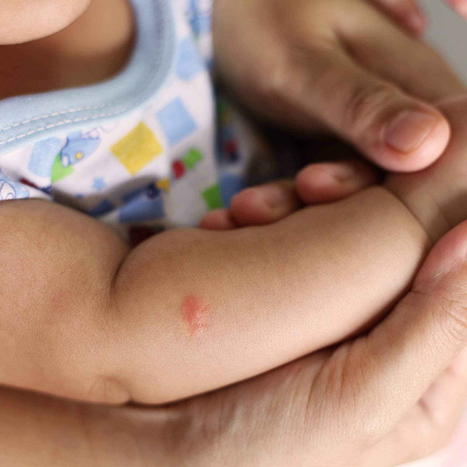 Nahaufnahme des Arms eines Babys mit einem kleinen roten Stich, der sanft von den Händen eines Erwachsenen gehalten wird. Das Baby trägt ein gemustertes ärmelloses Hemd.