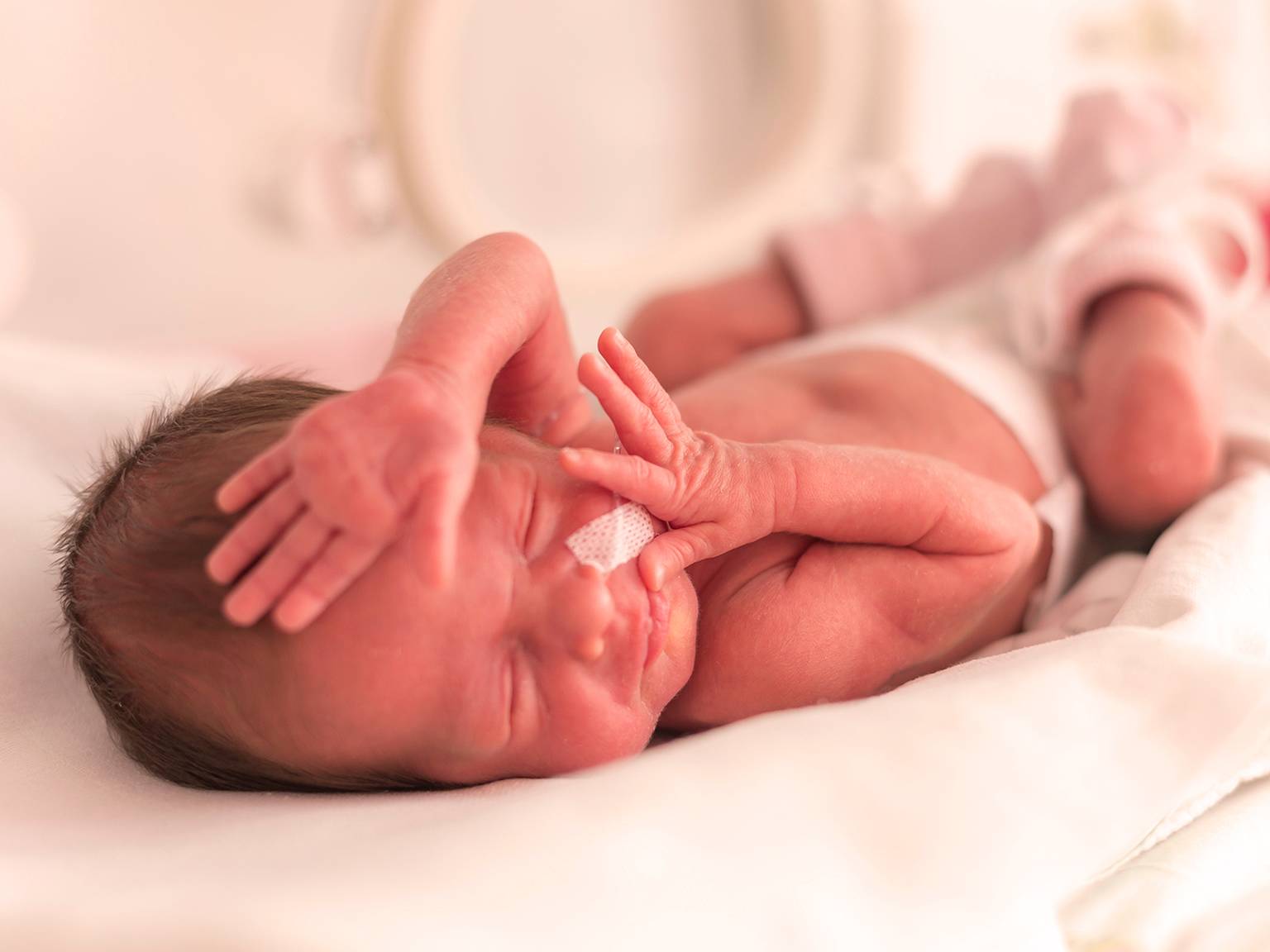 Neugeborenes Baby schläft in einem Krankenhaus, mit einem kleinen Verband auf der Nase und den Händen in der Nähe des Gesichts.