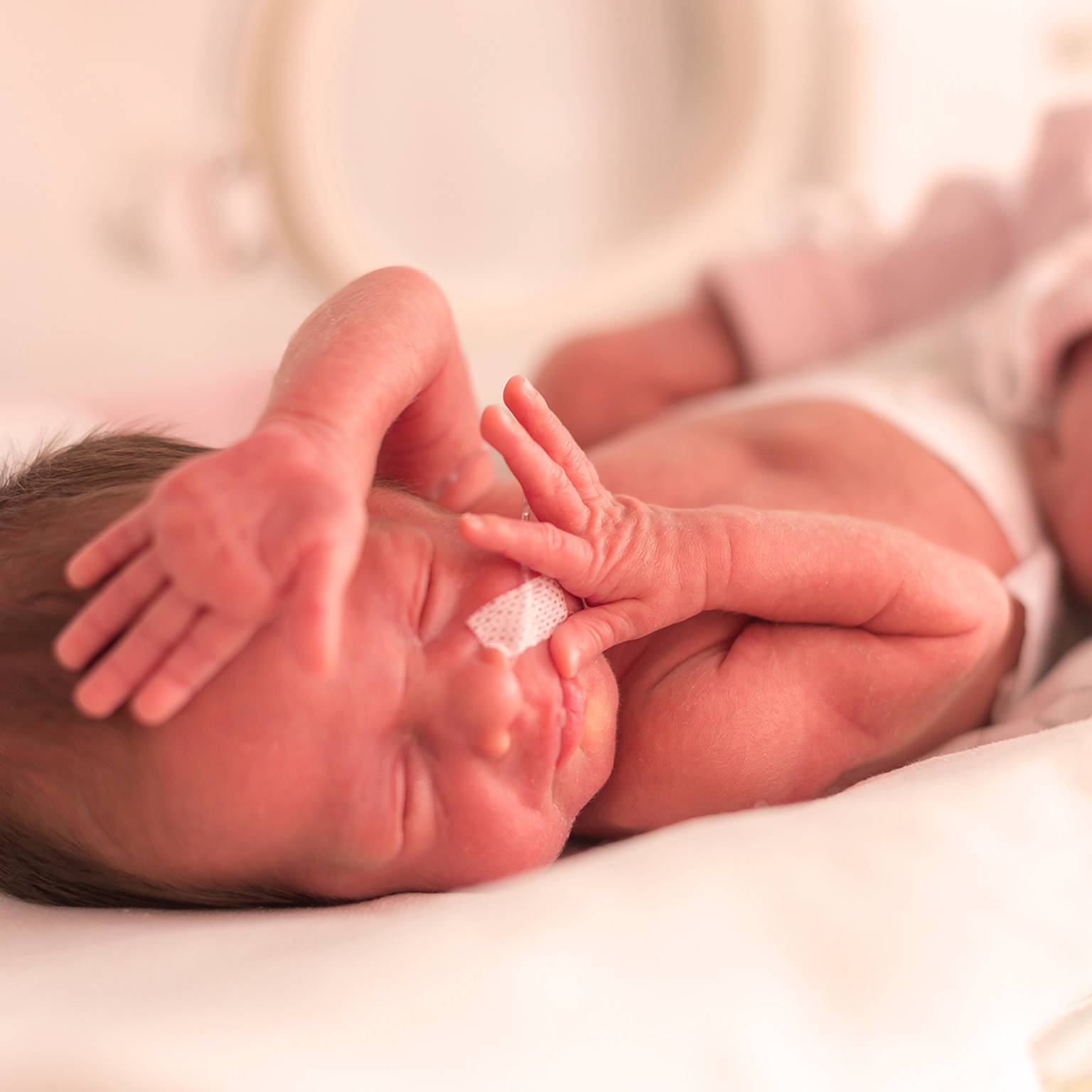 Neugeborenes Baby schläft in einem Krankenhaus, mit einem kleinen Verband auf der Nase und den Händen in der Nähe des Gesichts.