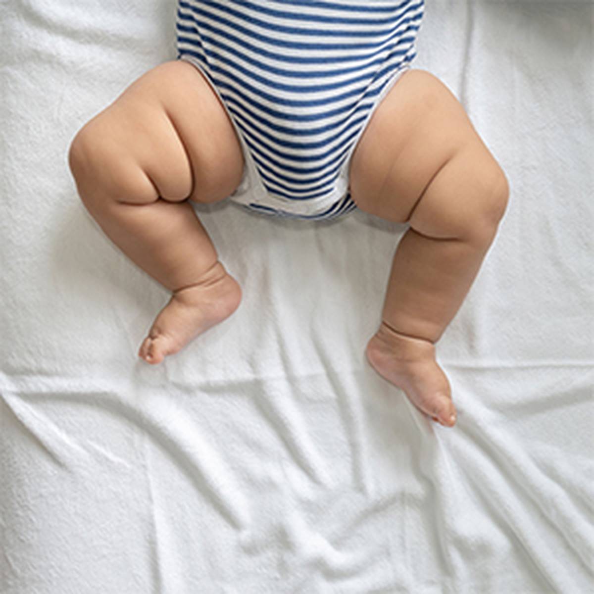 Ein Baby in einem blau-weiß gestreiften Strampler liegt auf einem weißen Laken. Seine pausbäckigen Beine und Füße sind gut sichtbar.