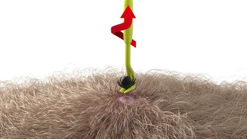 Nahaufnahme eines Zeckenhakens, das eine Zecke aus dichtem Fell entfernt, wobei Pfeile eine Aufwärts- und Drehbewegung anzeigen.