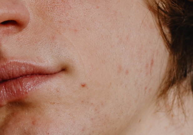 fs-insta-post-model-shot-1