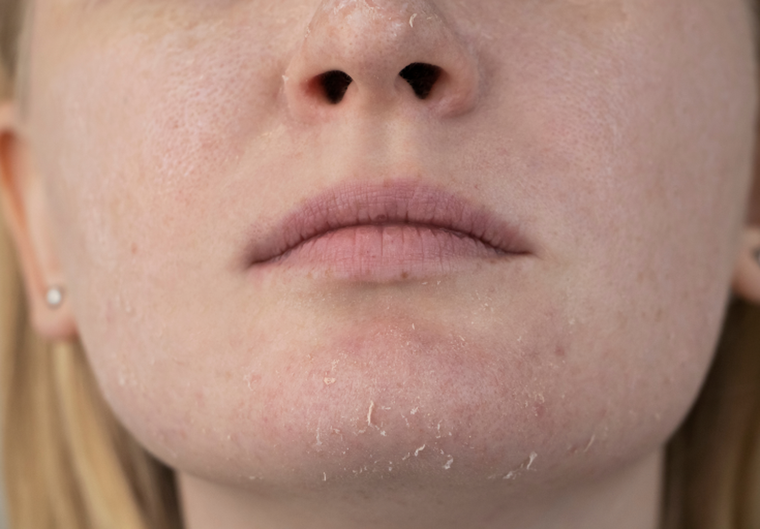 Top Gesichtspflege bei trockener Haut was hilft Dir?