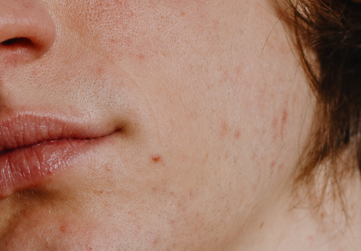 fs-insta-post-model-shot