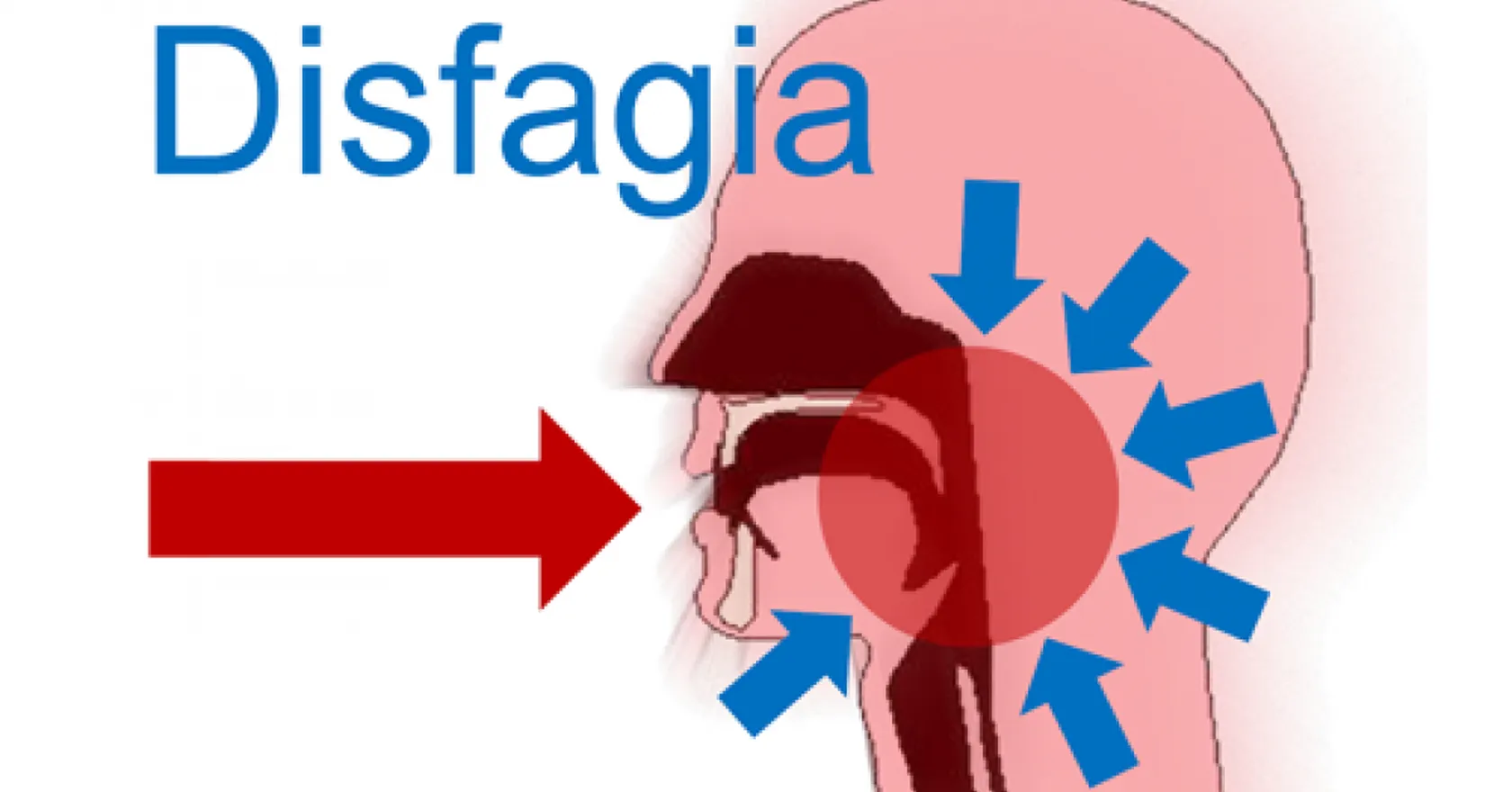 disfagia_01_x500.png